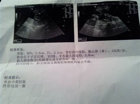 14周能看到胎儿器官吗