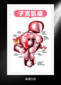 正确的子宫解剖结构