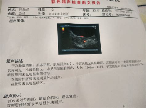 怀孕早期子宫周边可见星点状血彩