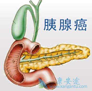 三种蔬菜对胰腺最好