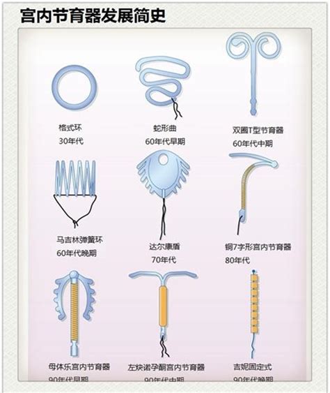 爱母环可以终身不取吗
