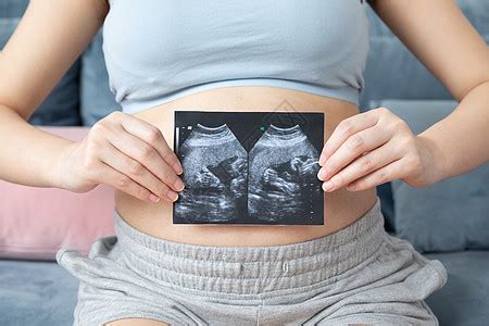 怀孕40天b超图片