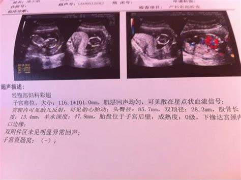 胎位什么时候固定下来