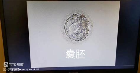 移植囊胚第五天尿能测出来吗