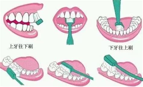 刷牙为什么要45度角