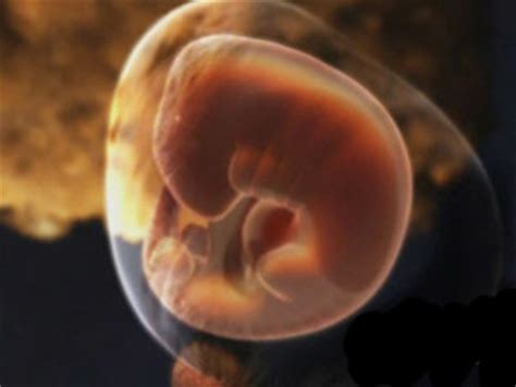 孕32周真实胎儿图片