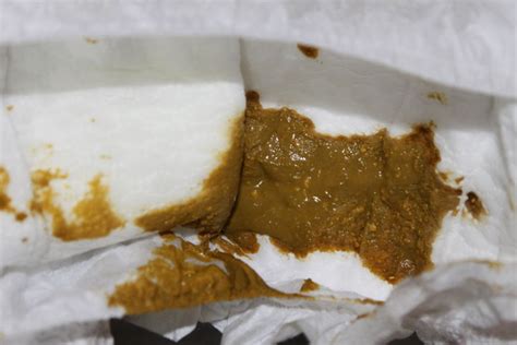 婴儿换了奶粉不拉便便
