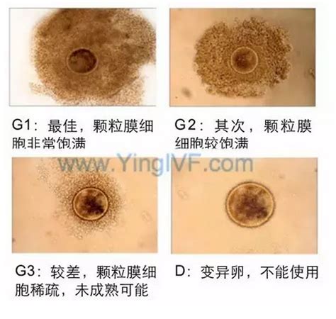 取完卵后冻胚几天可以移植