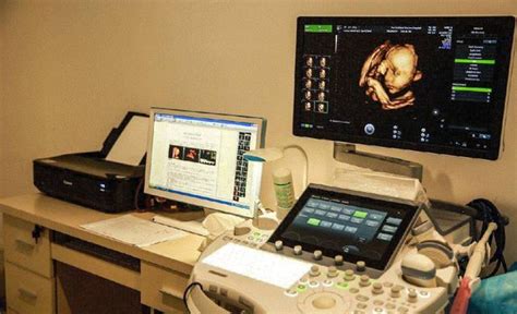 大排畸可以检查出胎儿哪些畸形