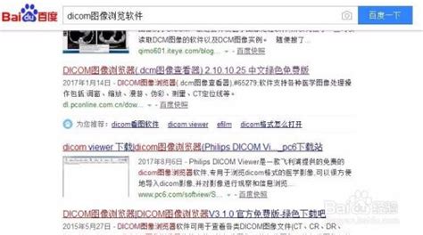 怎么把dcm格式转换为img格式