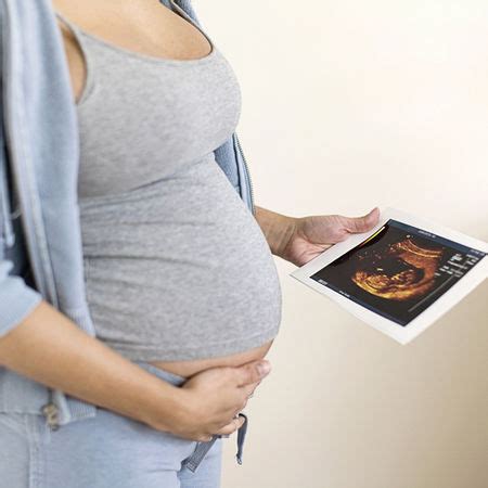 怎么问医生胎儿性别