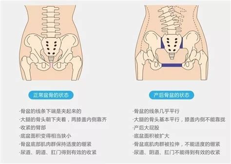 怀孕后几个月耻骨痛