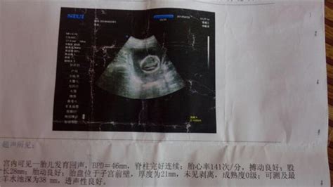 9周的胎儿b超图片