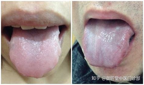 从舌头怎么看出得什么病?