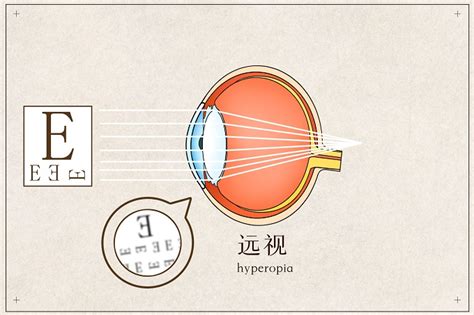 吃什么促进眼球发育