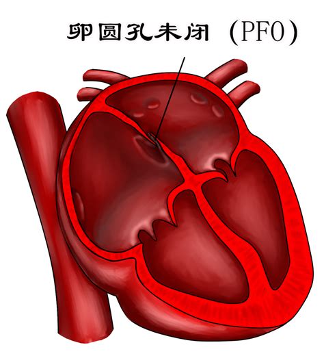 鼻中隔区卵圆形异常信号