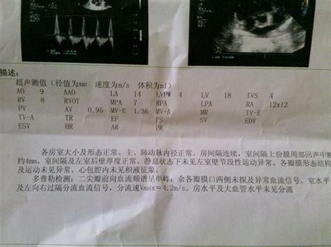 怀孕六个月查出先心病
