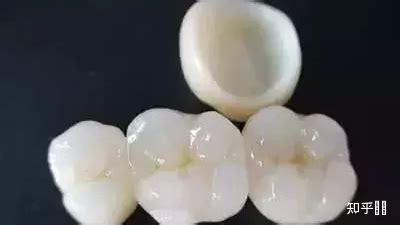 牙床低平能安假牙吗