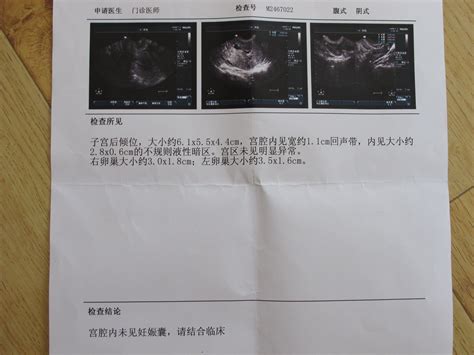 阴超刚刚看得见孕囊是怀孕多久