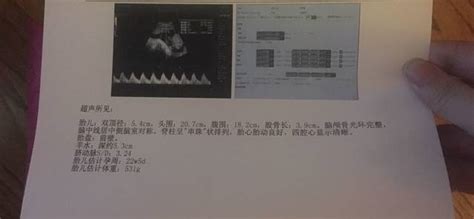 羊水少跟胎盘低有关系吗