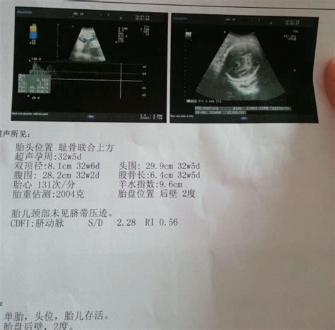 怀孕早期决定了胎宝宝的视力