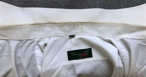 四维医生说准备黄色衣服