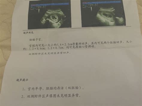 怀孕第16天