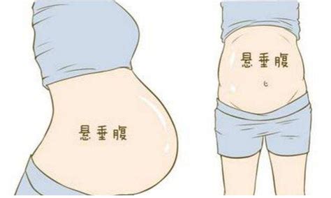 怀孕两个月肚子疼是怎么回事儿?
