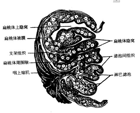 孩子为什么总是扁桃体发炎发烧