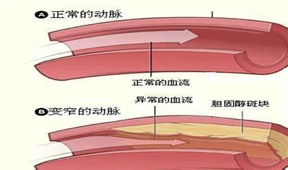 卵泡破裂了还会长吗