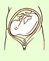孕31周臀位胎儿图片