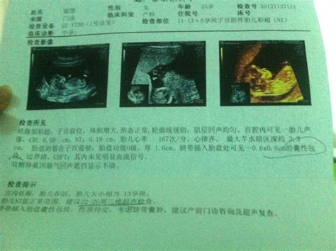 怀孕检查报告单