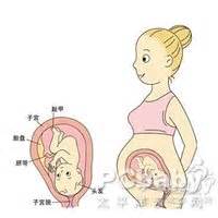 孕期怎样预防胎盘早剥