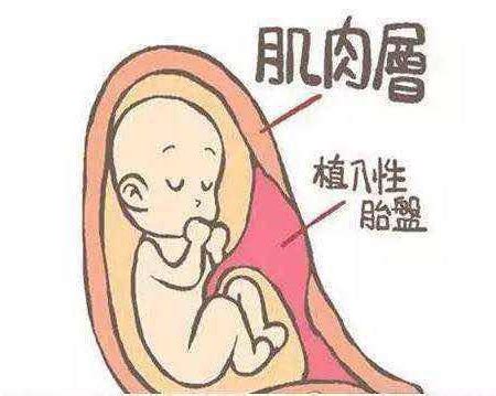纵隔子宫畸形可以怀孕吗