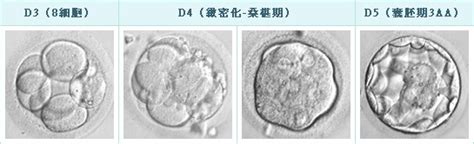 囊胚移植第3天白板