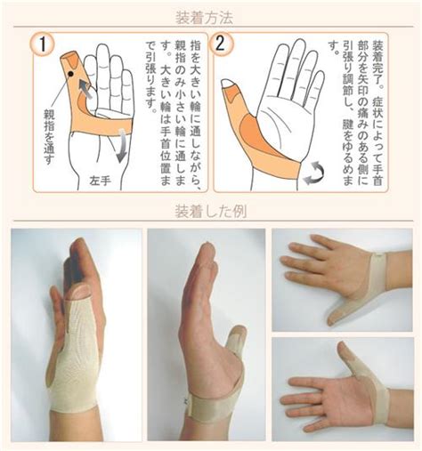 孕妇手麻是怎么回事儿