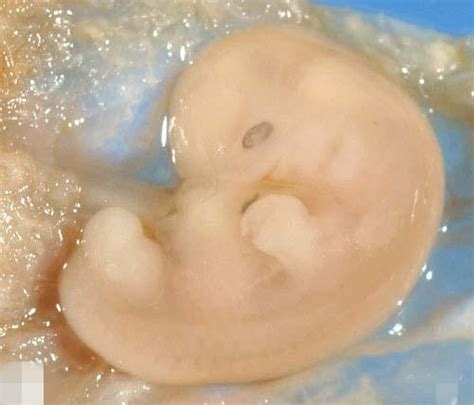 9周的胎儿发育图片