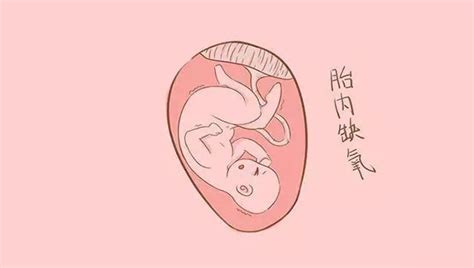 胎动连续超过40次提示宫内缺氧