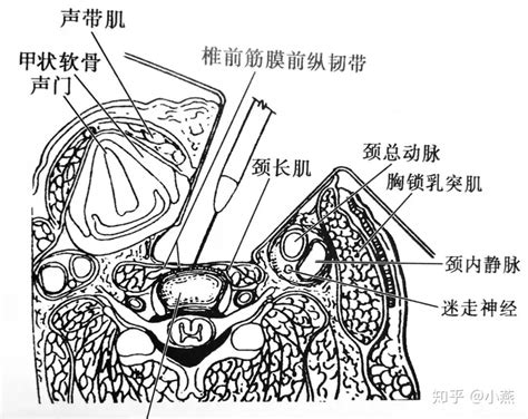 颈椎3-4-5-6节突出怎么锻炼