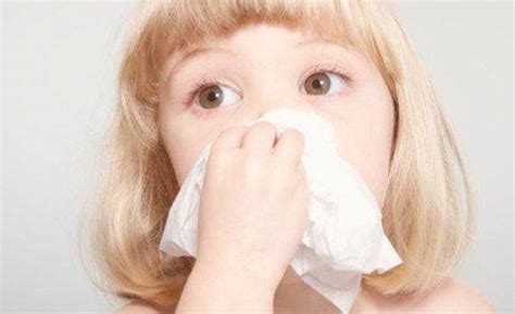 小孩流黄鼻涕可以吃小儿氨酚吗