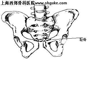 右侧下腹耻骨按压痛