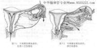 输卵管性不孕是什么原因引起的