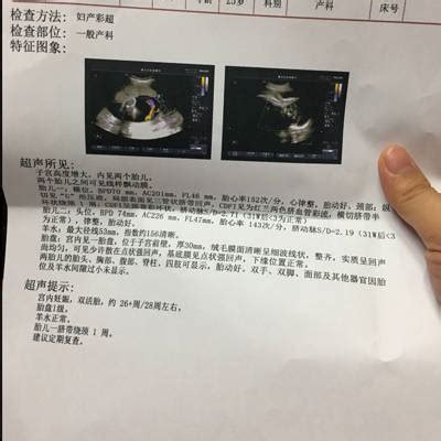 孕38周胎儿体重标准