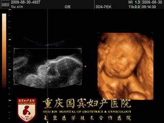 孕36周孕妇宫高腹围标准