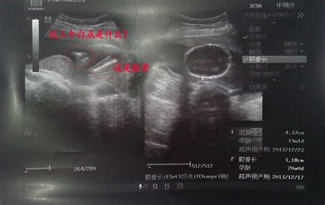 怀孕六个月左右胎儿图片