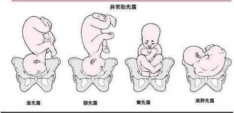 胎儿38周胎位还在变