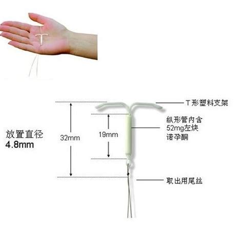 怀孕多少周能确定分娩方式