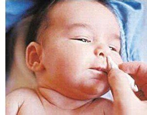 儿童感冒后期流黄鼻涕