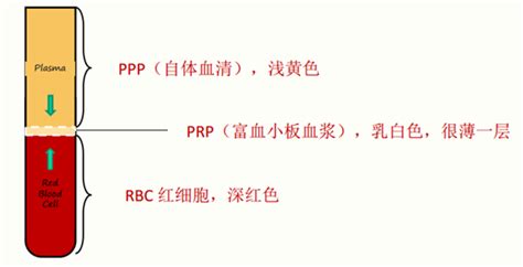 交换机支持PRP是什么意思