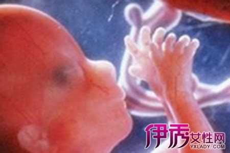 怀孕两个月胎停的征兆与图片